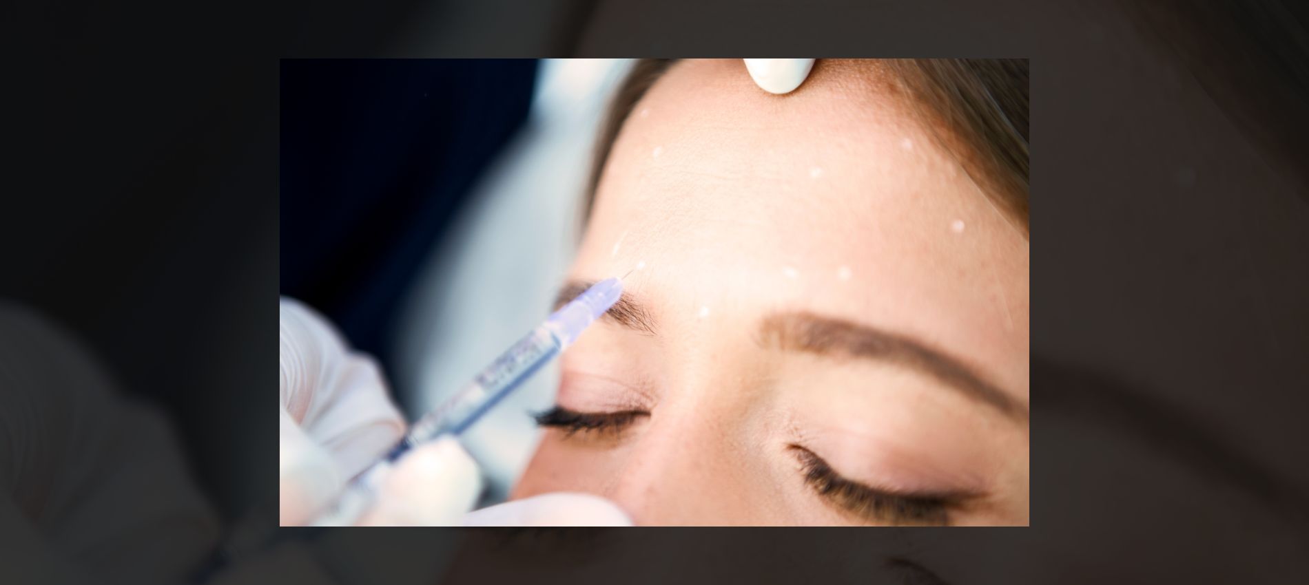 Tweakments: The Subtle Beauty Revolution You Need to Know About