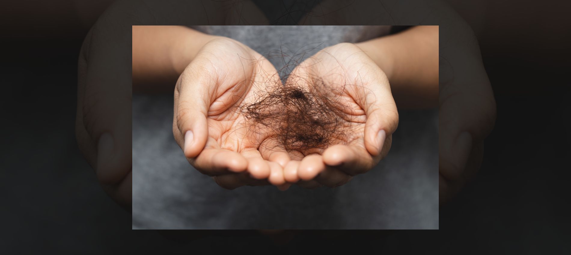 In this article, we’ll dive into five symptoms of abnormal hair fall that you shouldn’t ignore. Hopefullly it will help you!