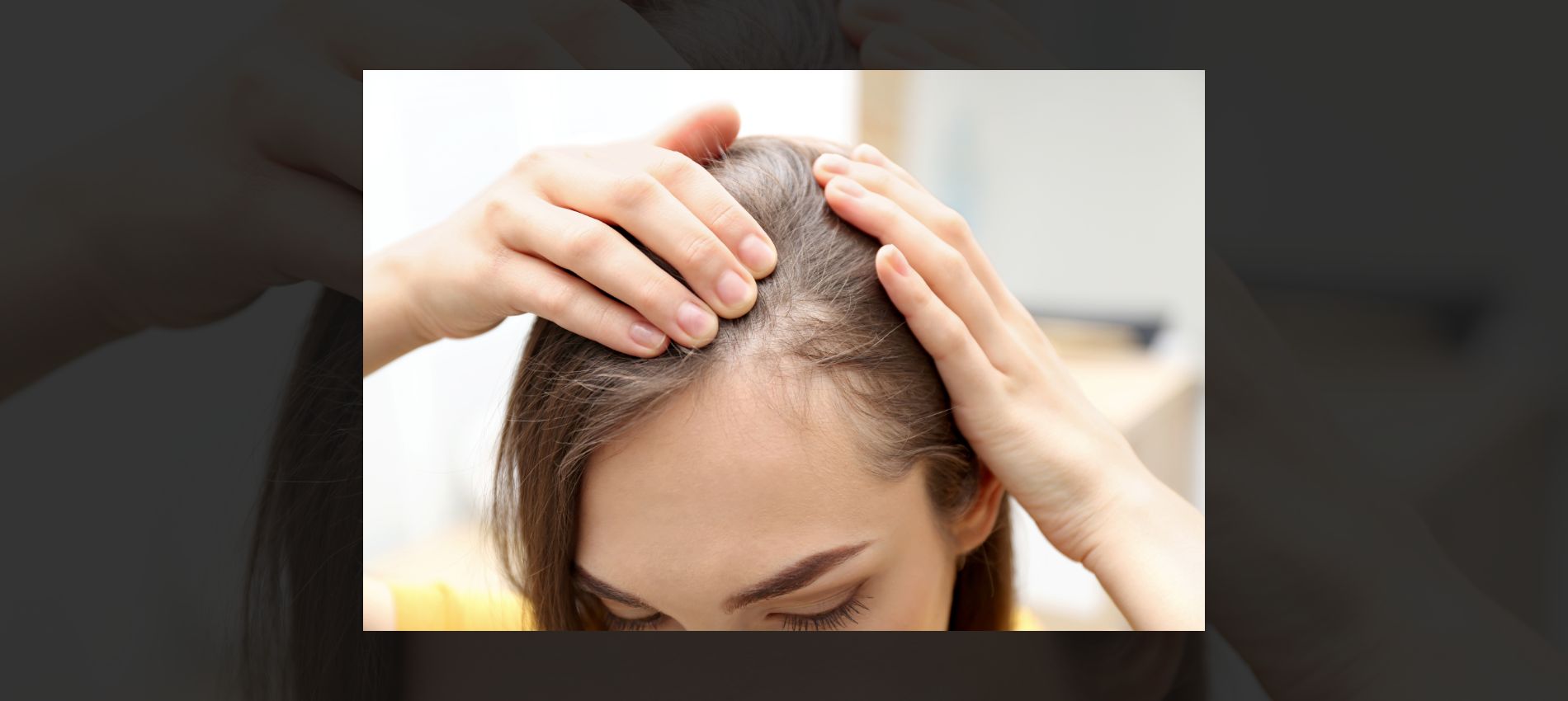 Want Rapunzel-Like Locks? 5 Foods to Supercharge Your Hair Growth Naturally!