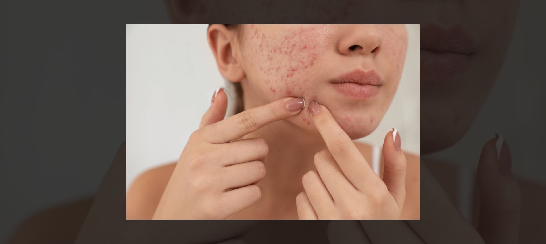 Why Your Skincare Isn’t Working (Yet)—And What You Can Do About It